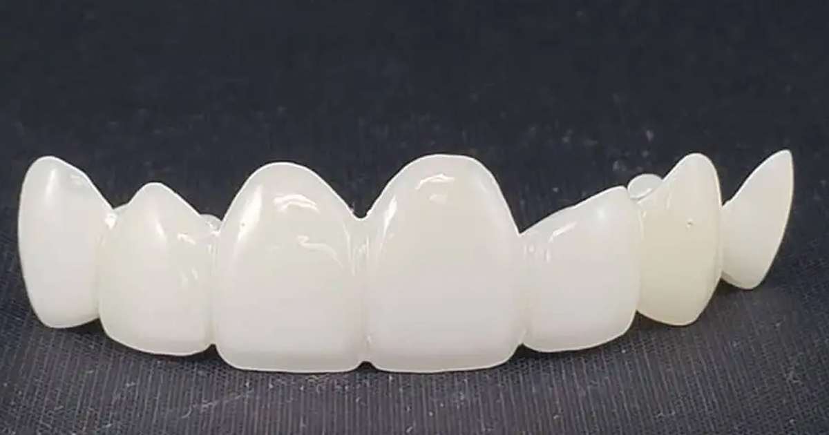 Can All-Ceramic Crowns and Bridges Prevent Further Tooth Loss What You Need to Know