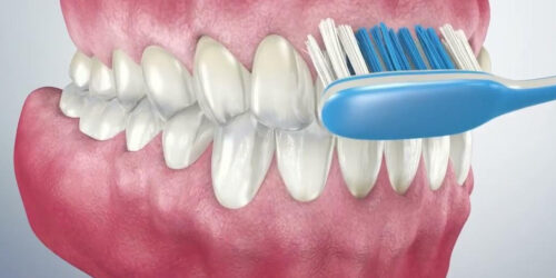 Brushing