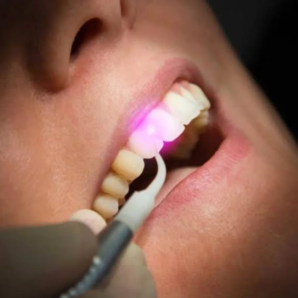 Laser Dentistry